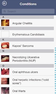 HIV Oral Diseases Screenshot Image