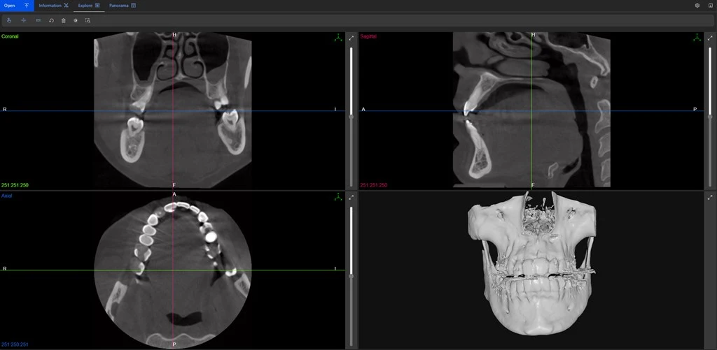 Dentinsight CT Viewer Screenshot Image #1