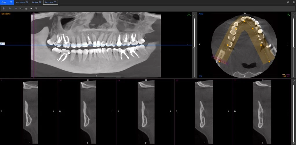 Dentinsight CT Viewer Screenshot Image #2